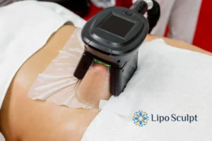 Does Fat Freezing At Home Work? 3 Fat freezing at home from Lipo Sculpt Southsea